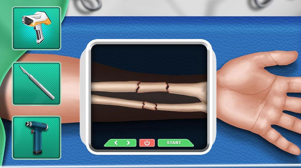 open heart surgery new games download free