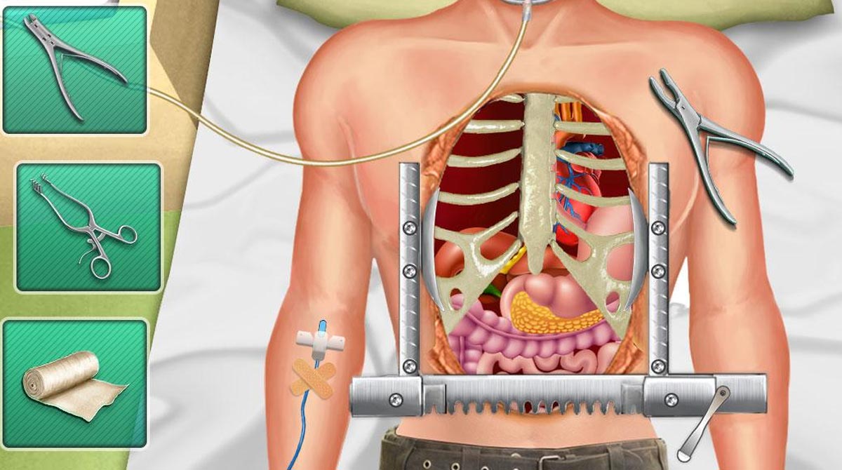 open heart surgery new games download full version