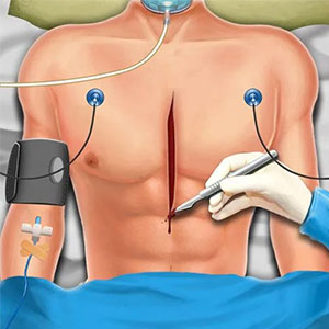 open heart surgery new games free full version